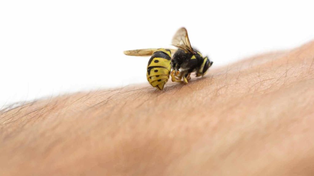 bee-sting-first-aid