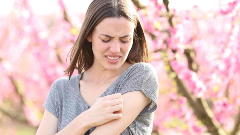 first aid for a wasp sting