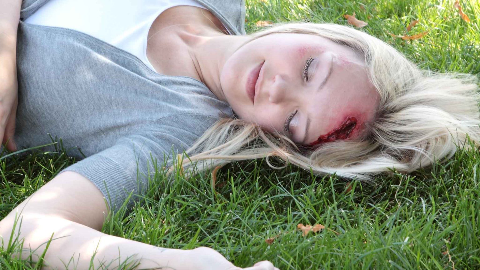 First Aid For Head Injury The First Aid Nest