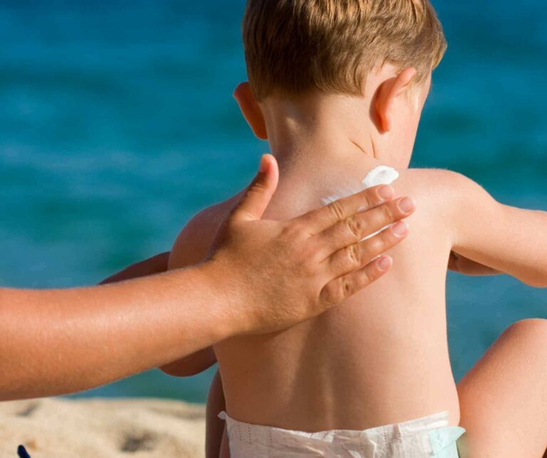 baby-sunburn-care-guide