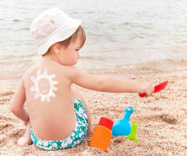 baby-sunburn-first-aid-treatment