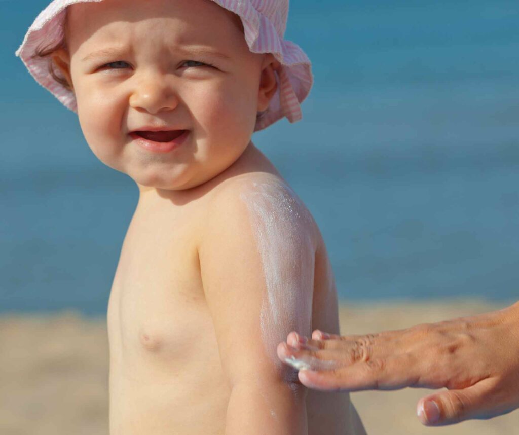 baby-sunburn-warning-signs