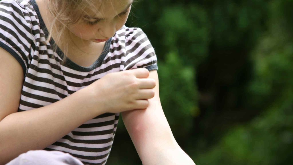 australian-spider-bite-first-aid