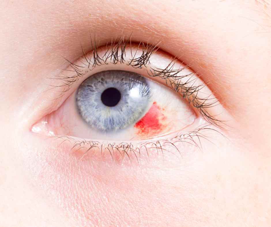 common-eye-injuries-in-children-and-treatment