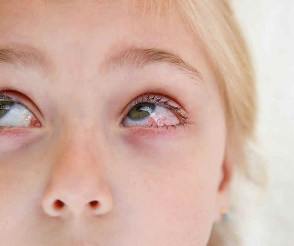 emergency-first-aid-for-child-eye-trauma