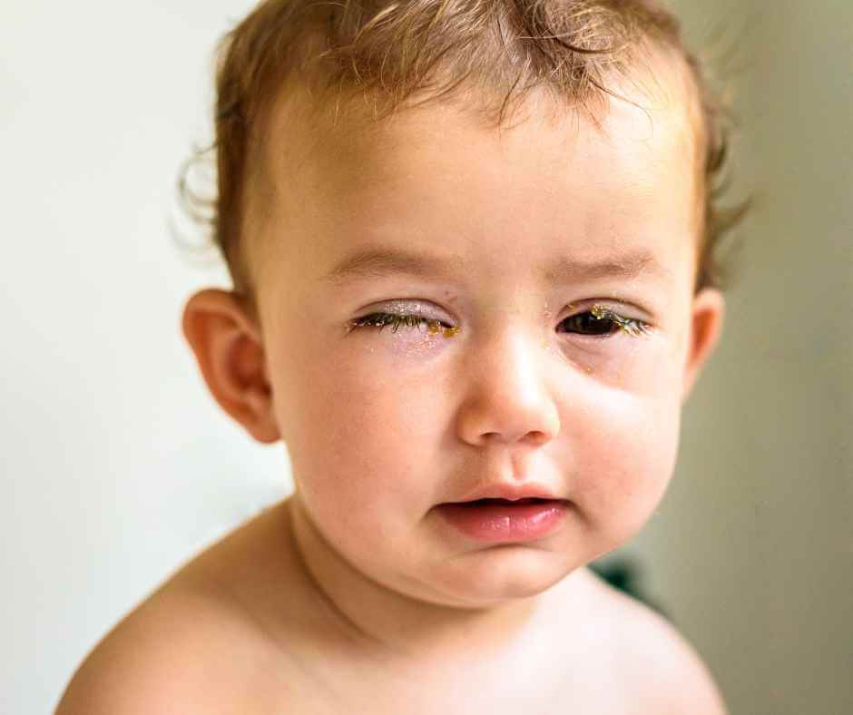 how-to-treat-kids-eye-injuries-safely