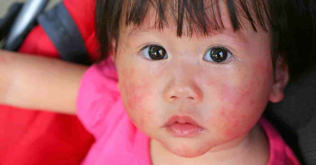 Essential Baby First Aid Skills Every Aussie Mum Should Know
