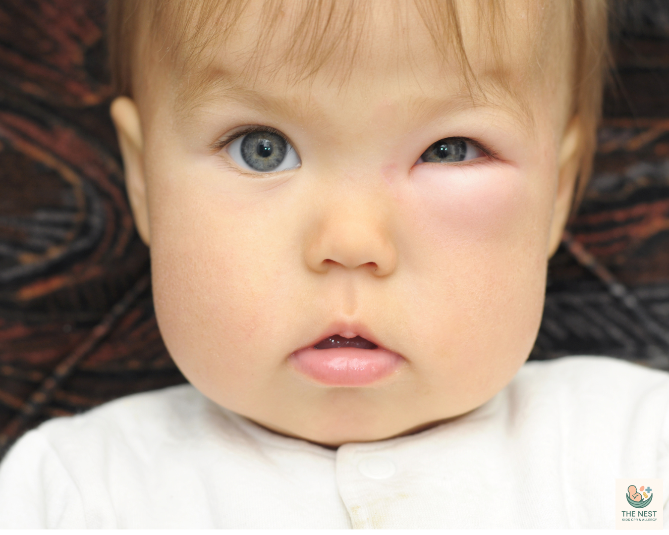 food allergy membership